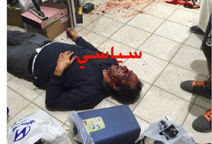 بالفيديو .. إعتداء كويتي على شاب مصري بوحشية .. ووفد مصرى لزيارة المصاب