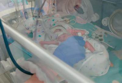 ابتكار طبي ثوري .. تجربة أول رحم اصطناعي بنجاح